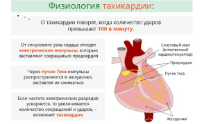 Все о тахикардии: чем опасна и как лечить