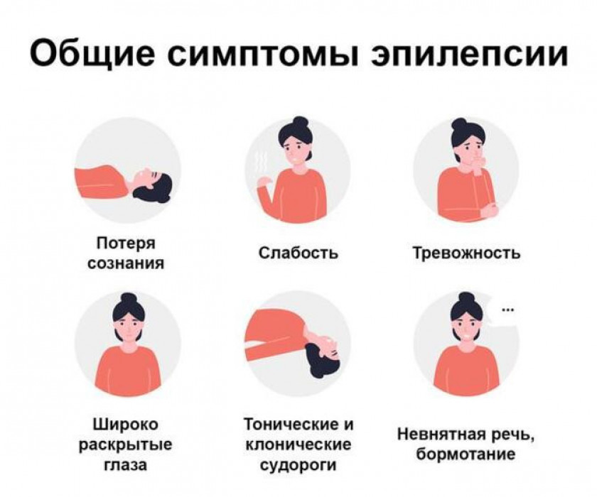 Эпилепсия - Изображение 2
