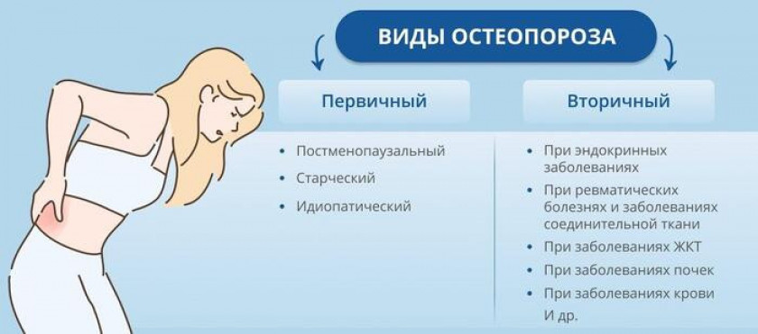 Остеопороз - Изображение 4