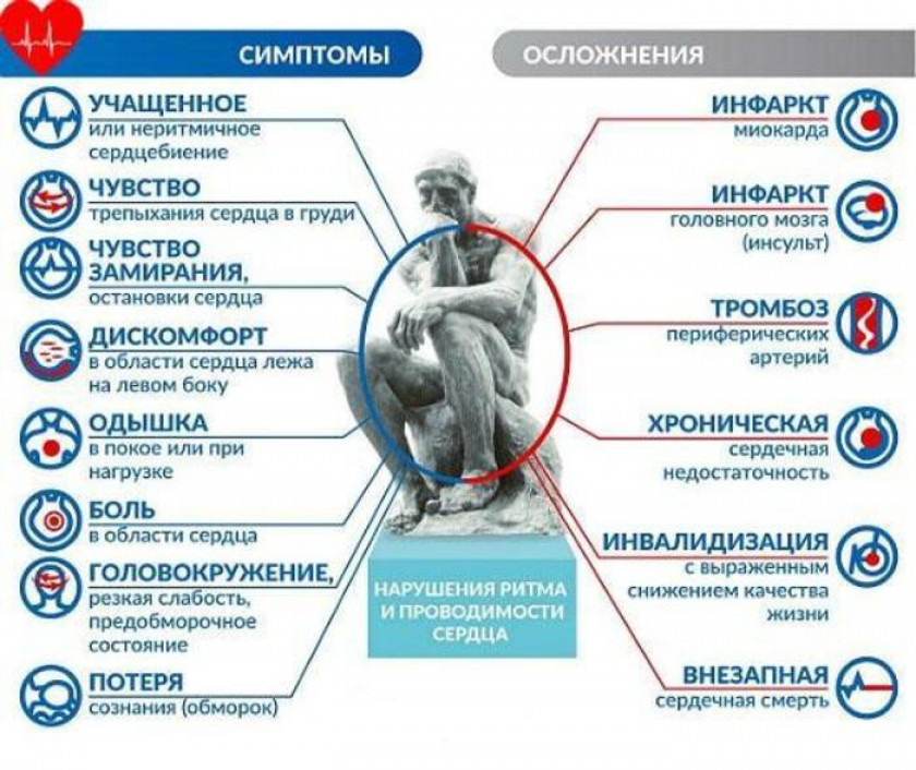 Аритмия сердца - Изображение 2