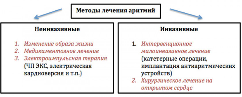 Аритмия сердца - Изображение 4