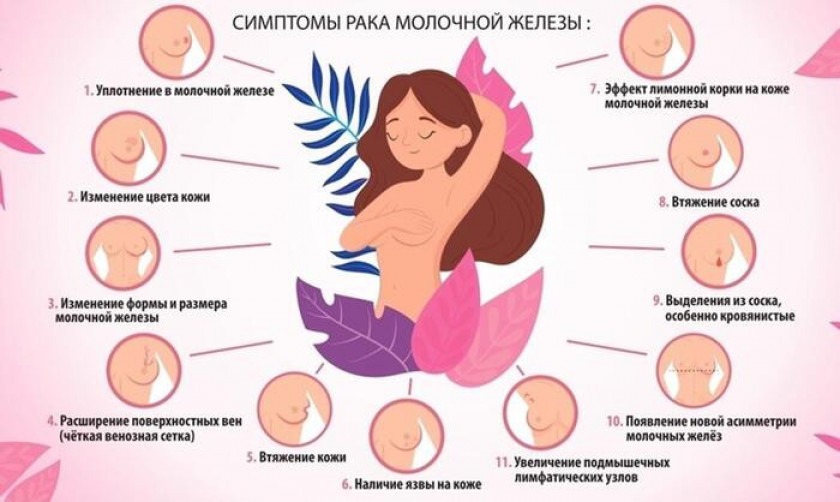Рак молочной железы - Изображение 2