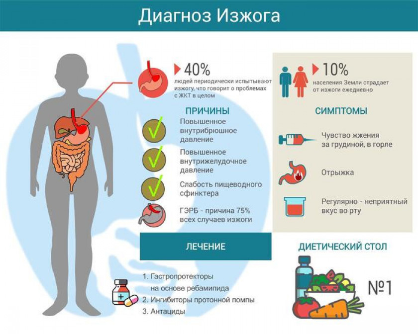 Изжога - Изображение 2